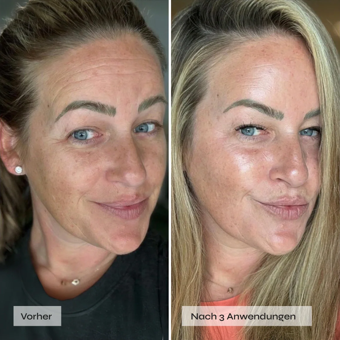 Kollagen Boosting Maske - Image 4