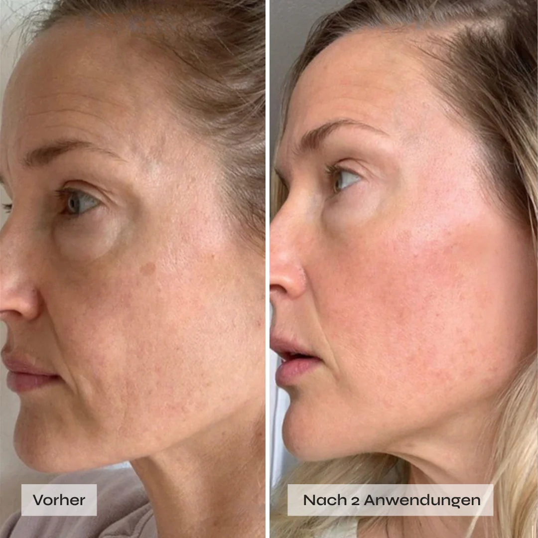 Kollagen Boosting Maske - Image 5