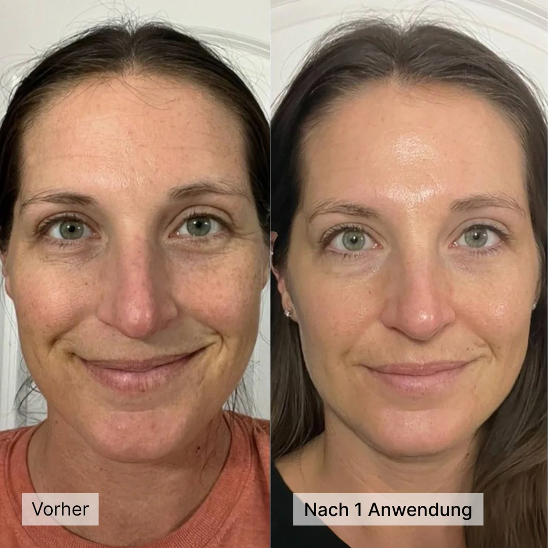Kollagen Boosting Maske - Image 6