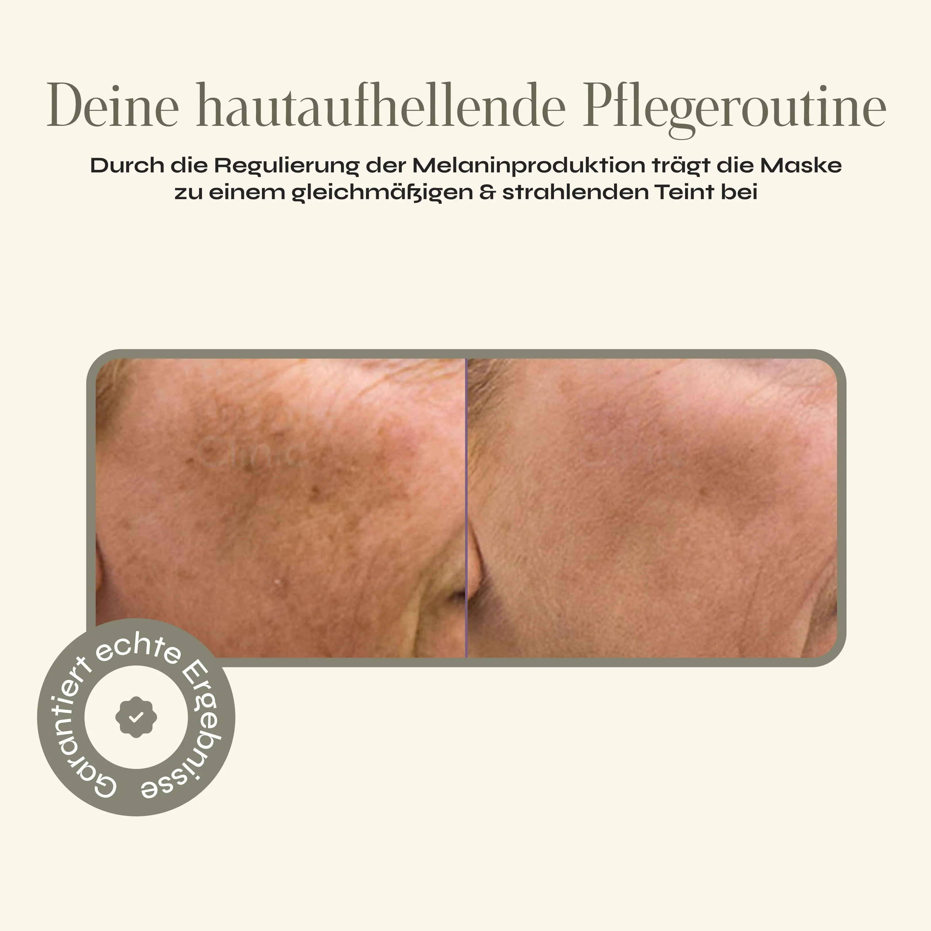 Pigment Control - Kollagen Boosting Maske - Image 3