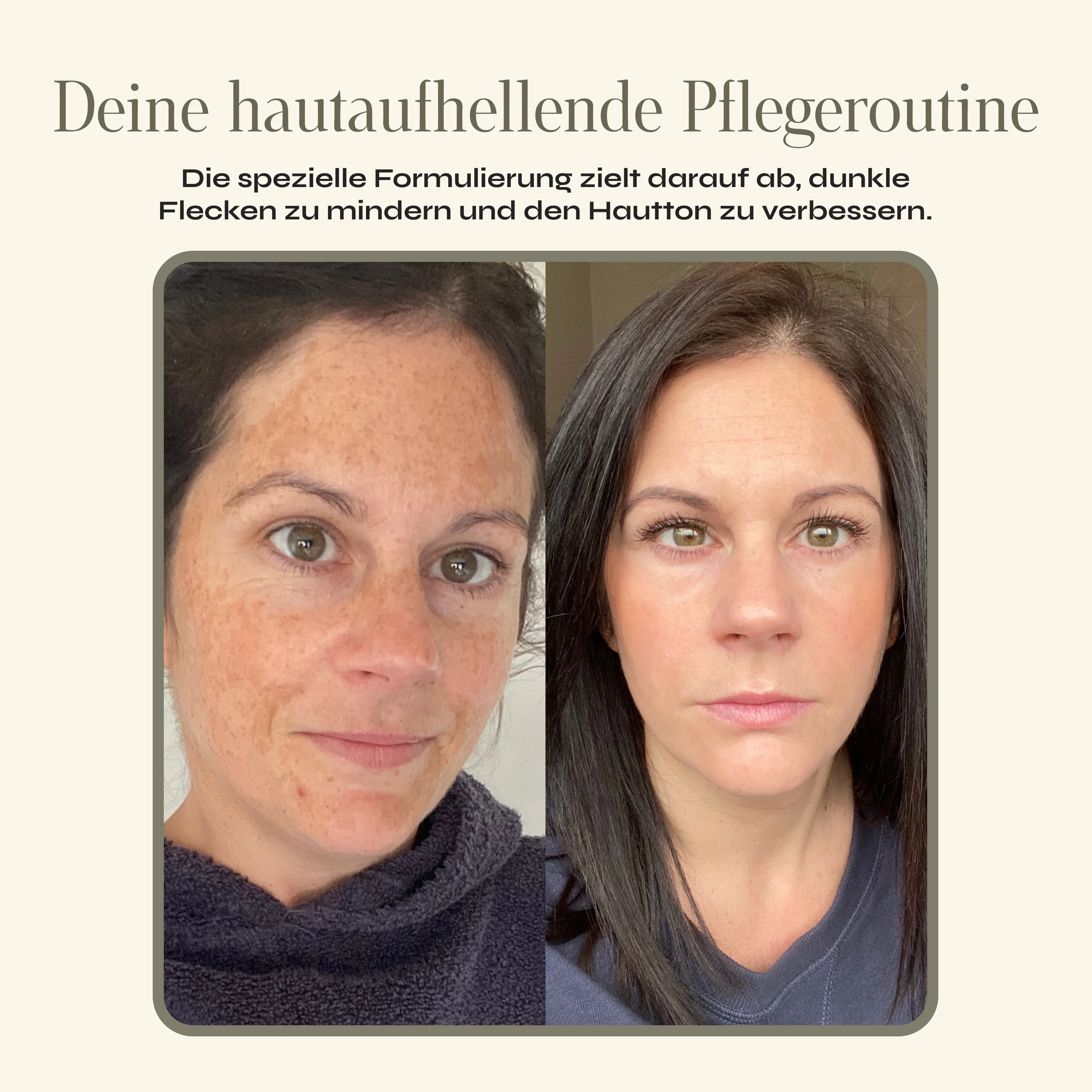 Pigment Control - Kollagen Boosting Maske - Image 4